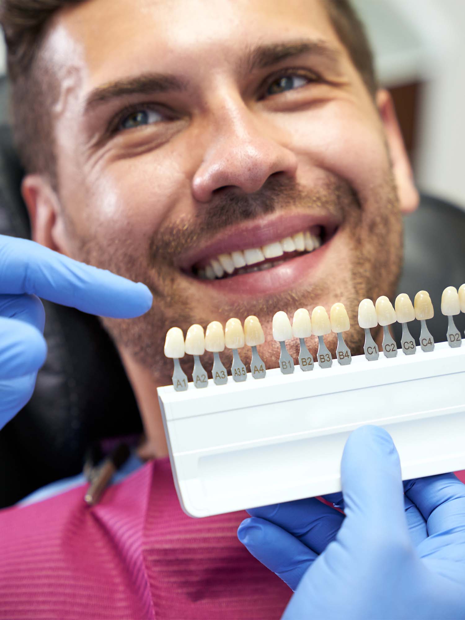 Tanden Bleken voor mannen bij Men's Bodyland